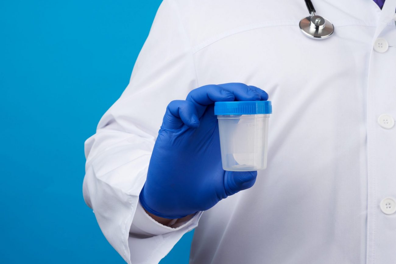 Photo of person in lab coat holding drug test cup.